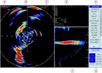 SU90 Low Frequency Omni Directional Sonar